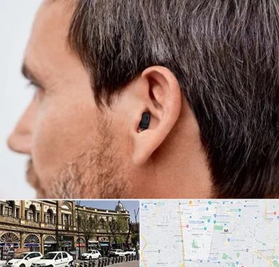 سمعک نامرئی در منطقه 11 تهران 