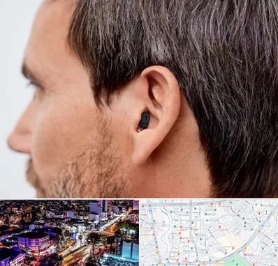 سمعک نامرئی در منظریه رشت 