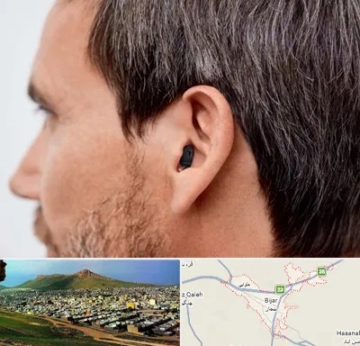 سمعک نامرئی در بیجار