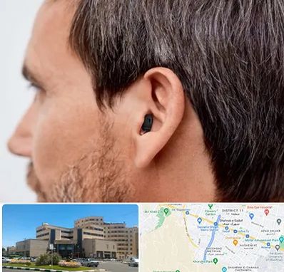 سمعک نامرئی در صیاد شیرازی مشهد 