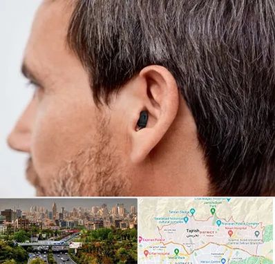 سمعک نامرئی در منطقه 1 تهران 