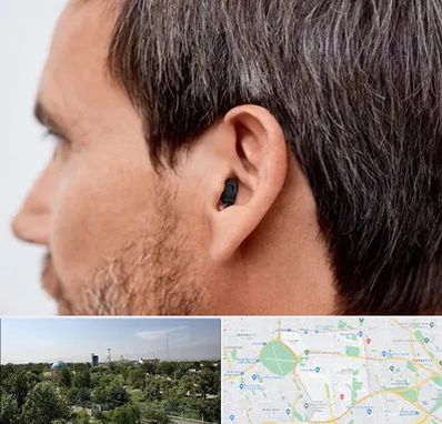 سمعک نامرئی در منطقه 16 تهران 