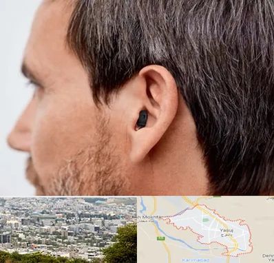 سمعک نامرئی در یاسوج