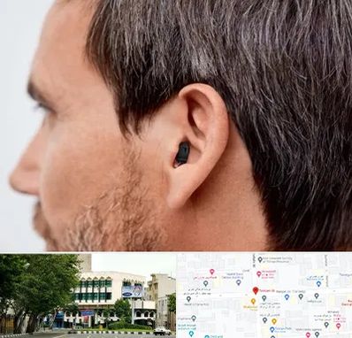 سمعک نامرئی در طالقانی 