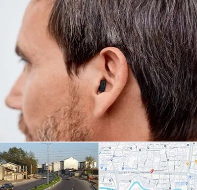 سمعک نامرئی در ضیابری رشت 