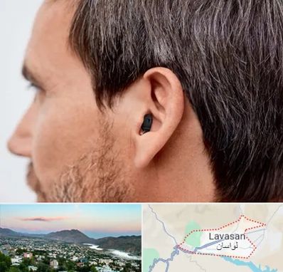 سمعک نامرئی در لواسان