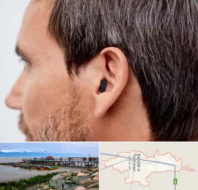 سمعک نامرئی در بندر ترکمن