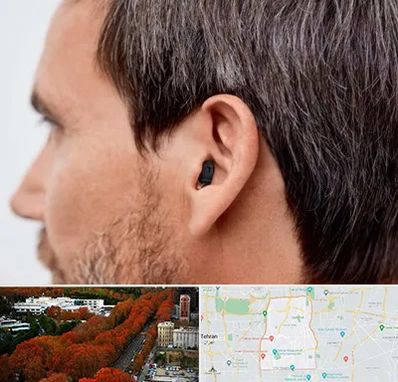 سمعک نامرئی در منطقه 6 تهران 