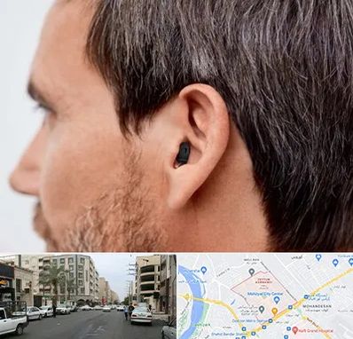 سمعک نامرئی در زیتون کارمندی اهواز 