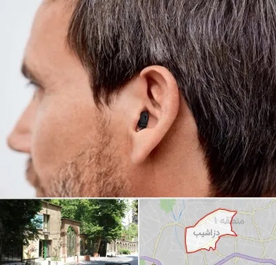 سمعک نامرئی در دزاشیب