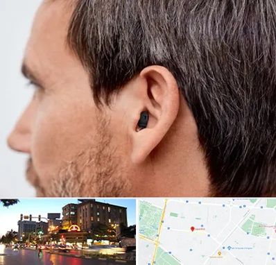 سمعک نامرئی در بلوار سجاد مشهد 