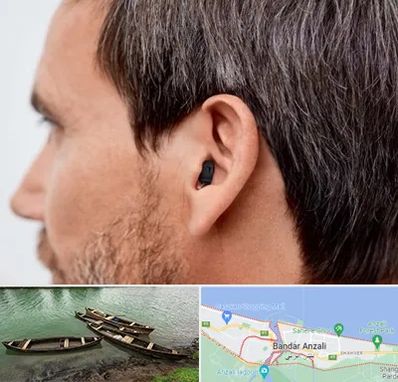 سمعک نامرئی در بندر انزلی