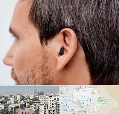 سمعک نامرئی در منطقه 14 تهران 