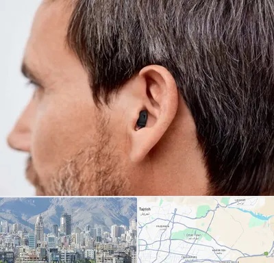 سمعک نامرئی در شمال شرق تهران