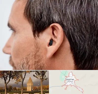 سمعک نامرئی در تویسرکان