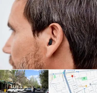 سمعک نامرئی در کوی فیروز تبریز