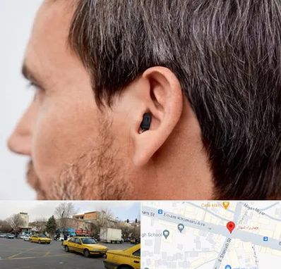 سمعک نامرئی در شهناز تبریز