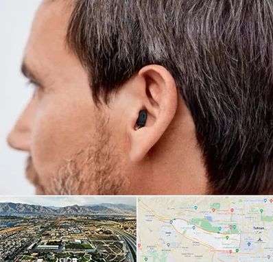 سمعک نامرئی در منطقه 21 تهران 