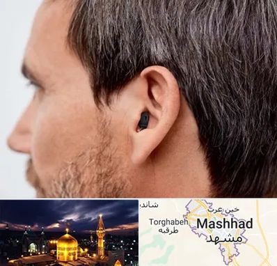 سمعک نامرئی در مشهد