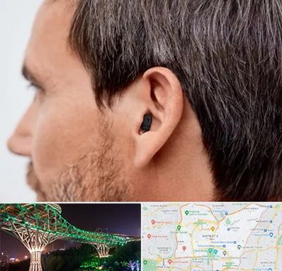 سمعک نامرئی در منطقه 3 تهران 