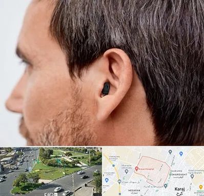 سمعک نامرئی در شاهین ویلا کرج 