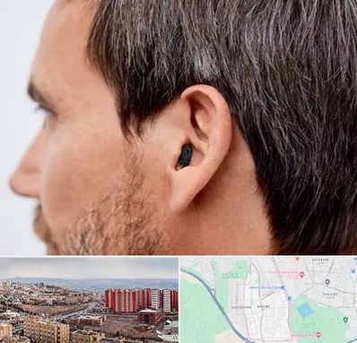 سمعک نامرئی در سهند تبریز