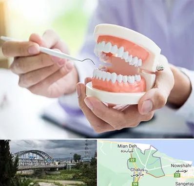 دندانسازی در چالوس