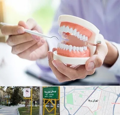 دندانسازی در تهران ویلا