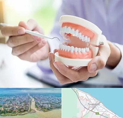 دندانسازی در تنکابن