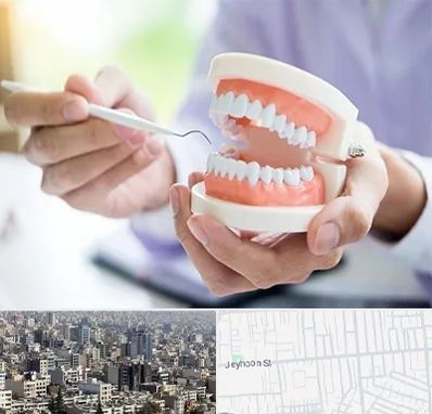 دندانسازی در جیحون