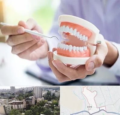 دندانسازی در اوین