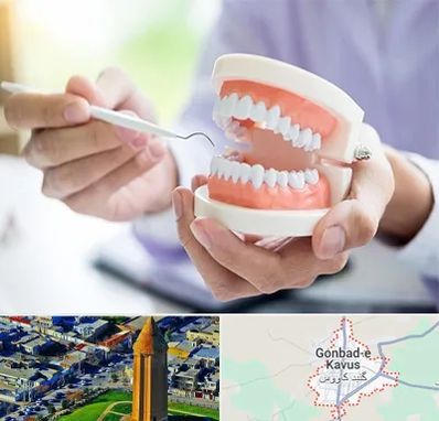 دندانسازی در گنبد کاووس