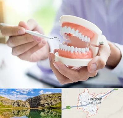 دندانسازی در فیروزکوه