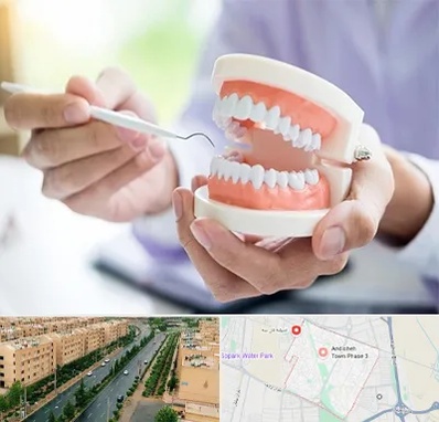 دندانسازی در فاز سه اندیشه