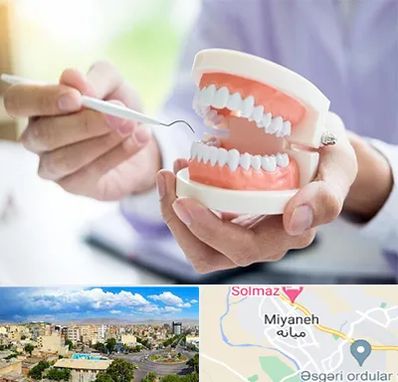 دندانسازی در میانه