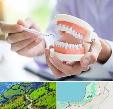 دندانسازی در گیلان