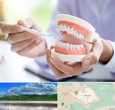 دندانسازی در مرند