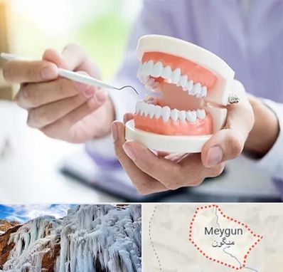 دندانسازی در میگون