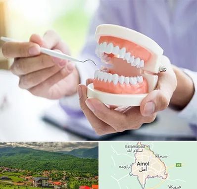 دندانسازی در آمل