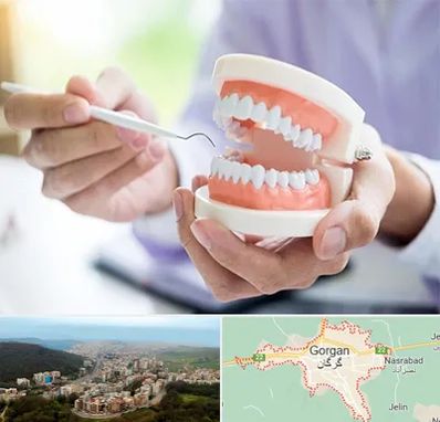 دندانسازی در گرگان