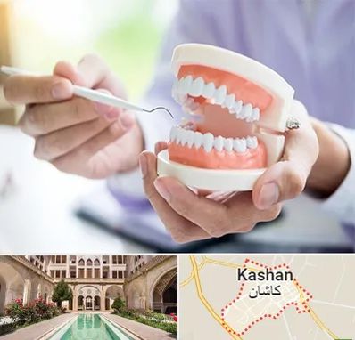 دندانسازی در کاشان