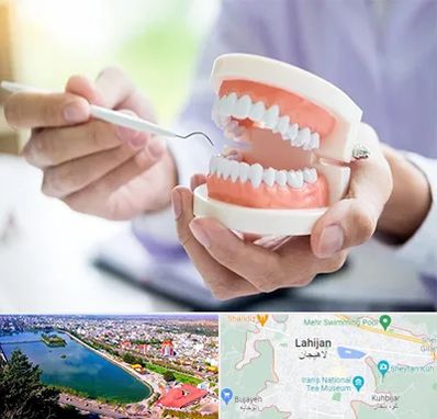 دندانسازی در لاهیجان
