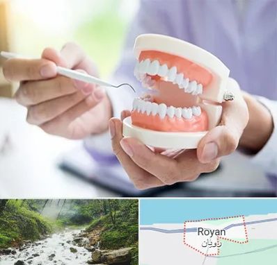 دندانسازی در رویان