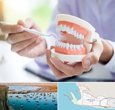 دندانسازی در چابهار