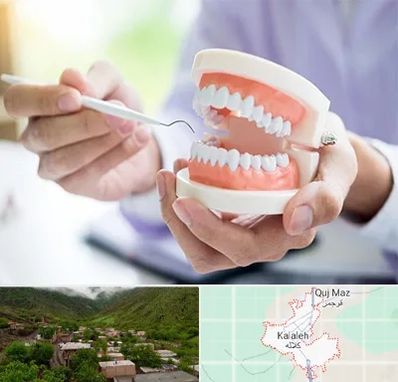 دندانسازی در کلاله