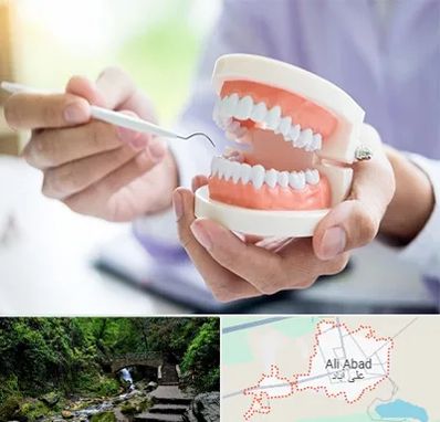 دندانسازی در علی‌ آباد کتول