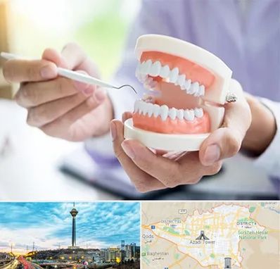 دندانسازی در تهران