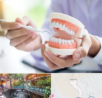 دندانسازی در درکه