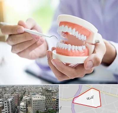 دندانسازی در آذری
