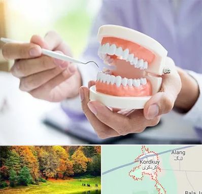 دندانسازی در کردکوی